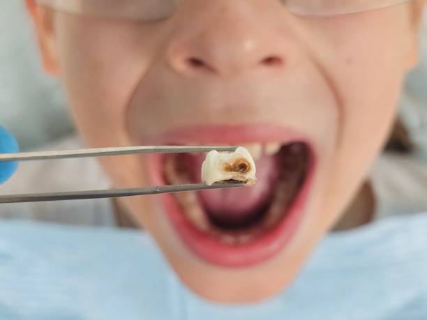 Best Broken Tooth Emergency  in New Port Richey, FL